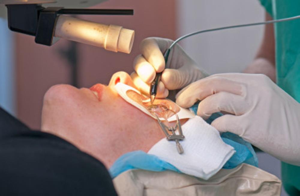 Laser treatment to stop wearing glasses