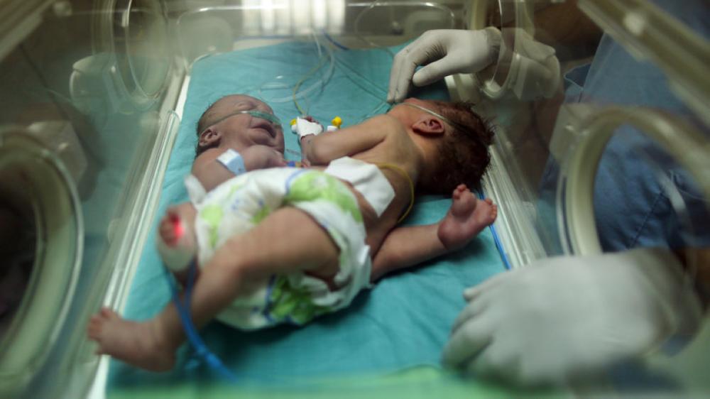 Farah and Haneen in an incubator a day after their birth.