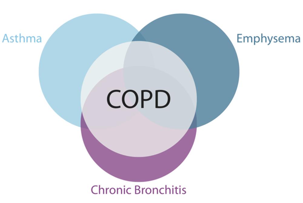 Preventing flare-up incidence in  people with COPD is critical to survival