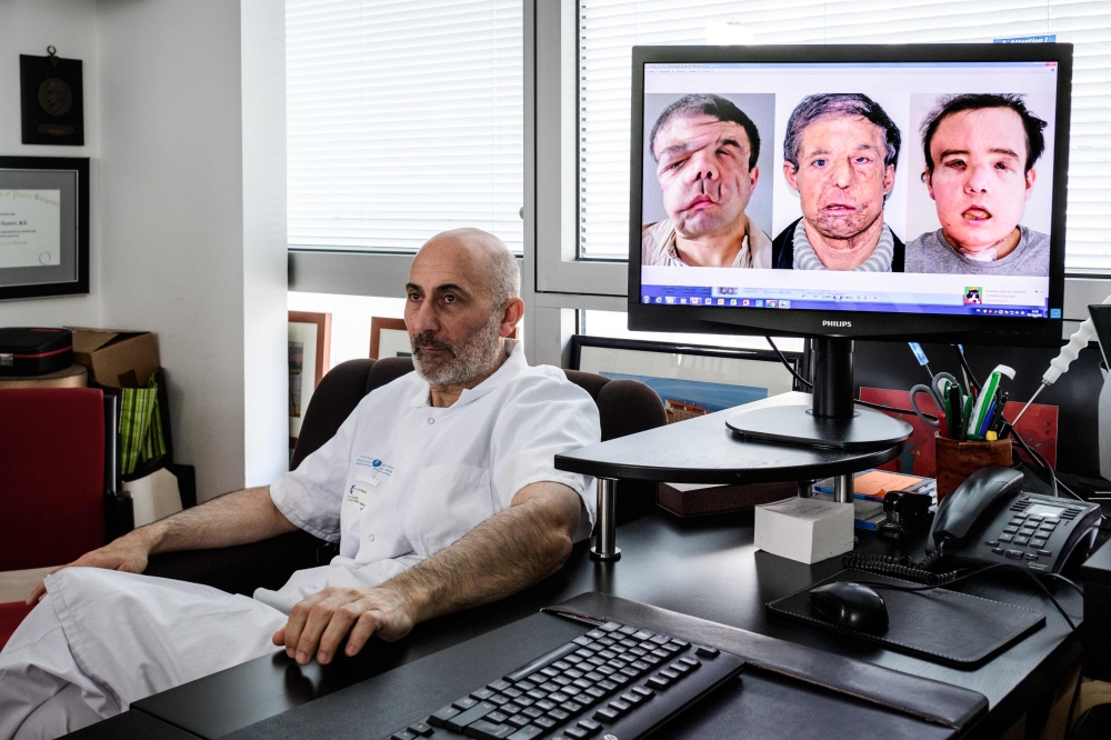 French medicine professor Laurent Lantieri, a specialist in hand and face transplant, poses next to a screen showing different steps of his patient Jerome Hamon’s surgery  at the Hopital Europeen Georges-Pompidou in Paris in this April 13, 2018 file photo. — AFP