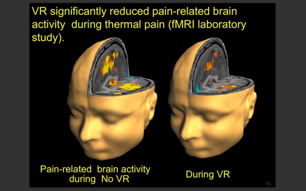 Virtual reality to change the face of healthcare