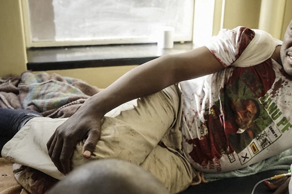 An injured man, wearing a bloodstained ZANU-PF shirt carrying the image of Zimbabwe President Emmerson Mnangagwa, lies on a hospital bed in Bulawayo on Saturday, following an explosion at the end of an election rally of the president. — AFP