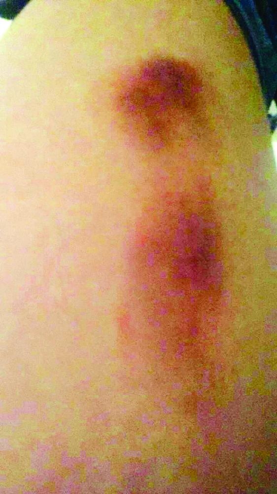 


At least three girls sustained injuries in the school brawl in Al-Waziriyah district of Jeddah.