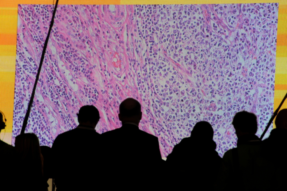 Cancer cells are seen on a large screen connected to a microscope at the CeBit computer fair in Hanover, Germany. -Reuters