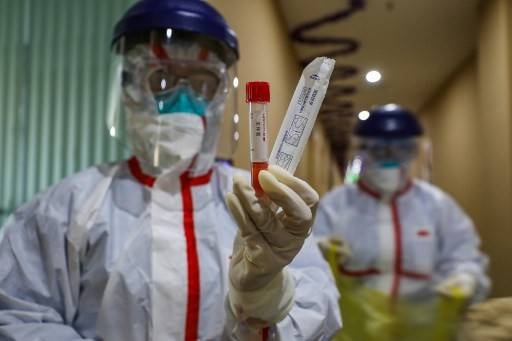 This photo taken on Feb. 4, 2020 shows a medical staff member showing a test tube after taking samples taken from a person to be tested for the new coronavirus at a quarantine zone in Wuhan, the epicenter of the outbreak, in China's central Hubei province. — AFP
