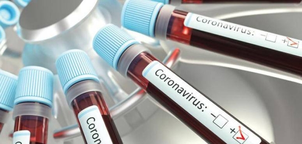 The United Arab Emirates on Friday registered 216 new coronavirus cases, taking the total number of confirmed infections in the country to 62,061. — Courtesy photo