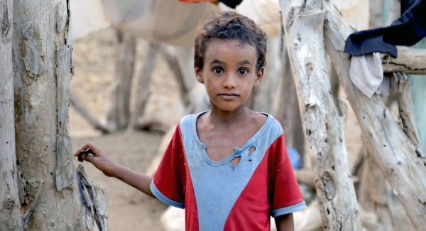 Millions of children across Yemen face serious threats due to malnutrition, in particular, and the lack of basic health services. All these threats are caused by the ongoing war and hostilities in the country. — File photo courtesy UNICEF/UN0276430/Almahbashi