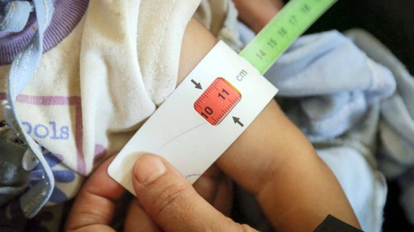 A seven-month-old child, in Yemen, has their upper arm measured to check for malnutrition. Ongoing conflict has triggered widespread food insecurity across the country, leaving thousands of children severely and acutely malnourished. — courtesy UNICEF/Motaz Fuad
