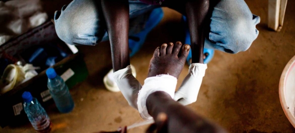 A young boy receives treatment for Guinea worm disease in South Sudan in this file picture. — Courtesy photo