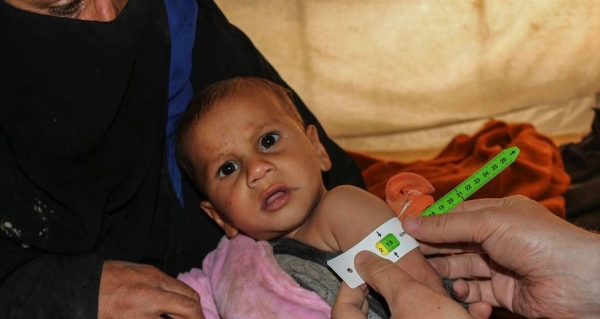 A baby is screened for malnutrition at Al-Hol camp in northern Syria. -- courtesy UNICEF/Masoud Hasen