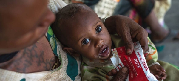 A one-year-old boy is treated for malnutrition at a health center in the Tigray region of northern Ethiopia. — Courtesy file photos
