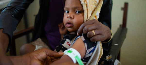 A one-year-old boy is treated for malnutrition at a health center in the Tigray region of northern Ethiopia. — Courtesy file photos
