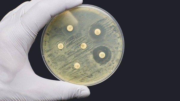 Lab test of antimicrobial resistance.