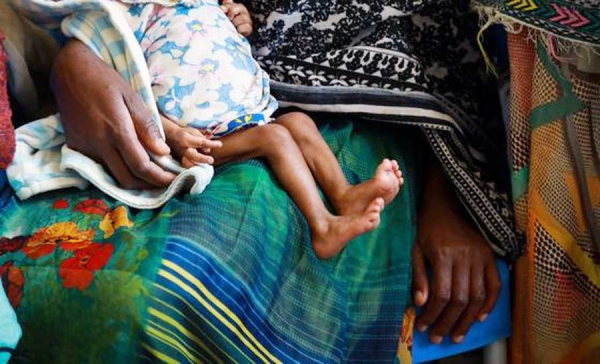 A nutrition worker measures the arm of a severely malnourished baby at a clinic in South Sudan. — courtesy UNICEF/Helene Sandbu Ryeng