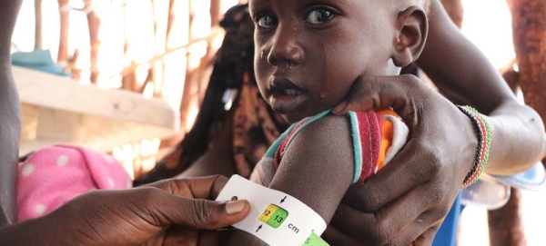 A malnourished child is assessed at a nutrition clinic in Fangak county, South Sudan. — courtesy WFP/Marwa Awad
