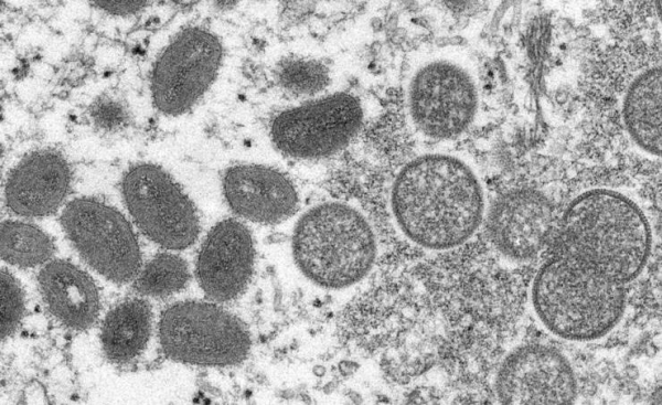 Monkeypox spreads in West, baffling African scientists