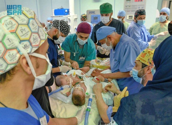 Saudi Arabia adds new achievement to its record of separating conjoined twins