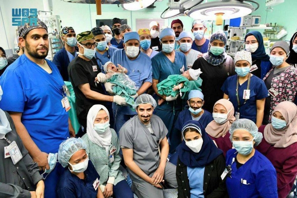 Saudi Arabia adds new achievement to its record of separating conjoined twins
