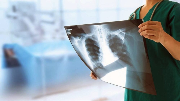 Machine learning is being used to discover new information from X-rays. — courtesy Canva