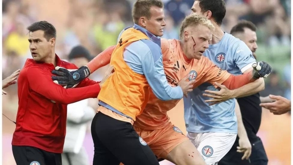 Melbourne City goalkeeper Thomas Glover was left with blood streaming down his face after he was attacked during the pitch invasion