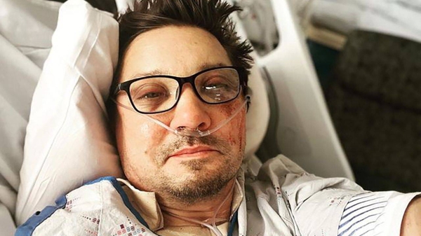 An image posted to Renner's Instagram account shows the actor in what appears to be a hospital bed with facial injuries