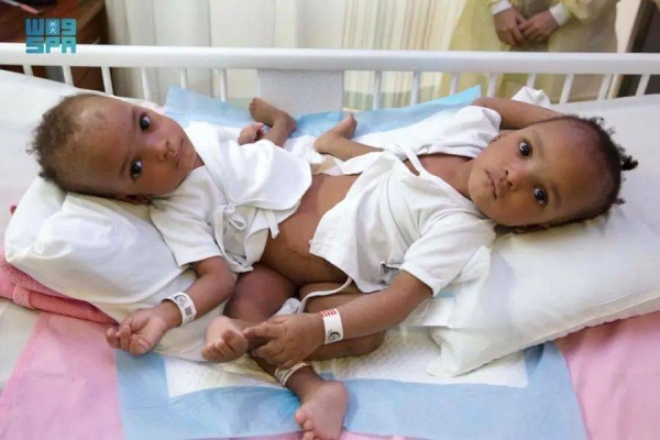 NIgerian twins Hassana and Hasina