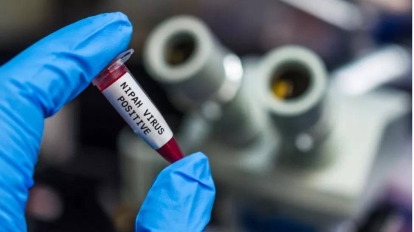 The Nipah virus is a zoonotic disease that can be transmitted from some animals to humans