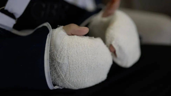 Mohammed Nazzal says his hands were broken during beatings in jail