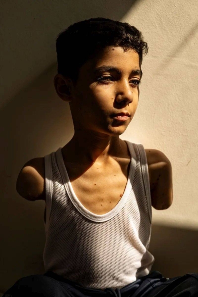 The portrait, taken by Palestinian photographer Samar Abu Elouf for the New York Times, shows nine-year-old Mahmoud Ajjour, who lost both arms in an Israeli airstrike in Gaza City in March 2024.