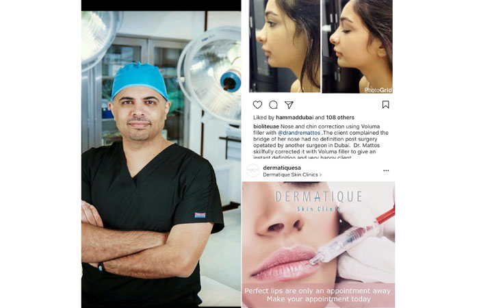 Plastic Surgery- The Pervasive Trend Among Young Arab Bloggers
